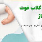 درمان کلاب فوت با ماساژ