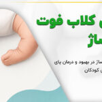درمان کلاب فوت با ماساژ